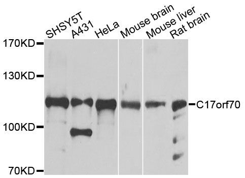 Western blot - C17orf70 Polyclonal Antibody (144-08591)