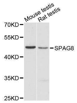 Western blot - SPAG8 antibody (144-08943)