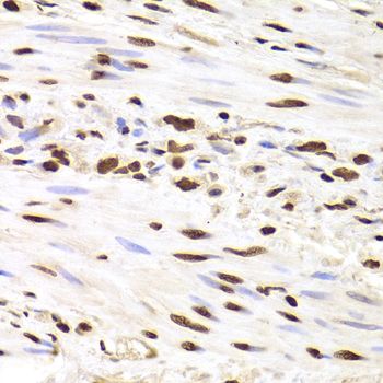 Immunohistochemistry - HNRNPD Polyclonal Antibody (144-01828)