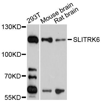 Western blot - SLITRK6 antibody (144-03521)