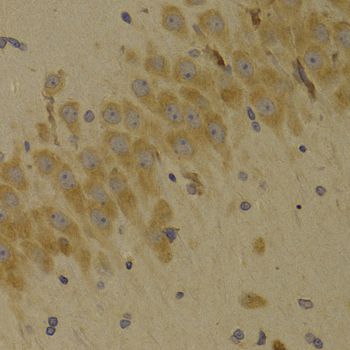 Immunohistochemistry - SCO2 Polyclonal Antibody (144-07051)