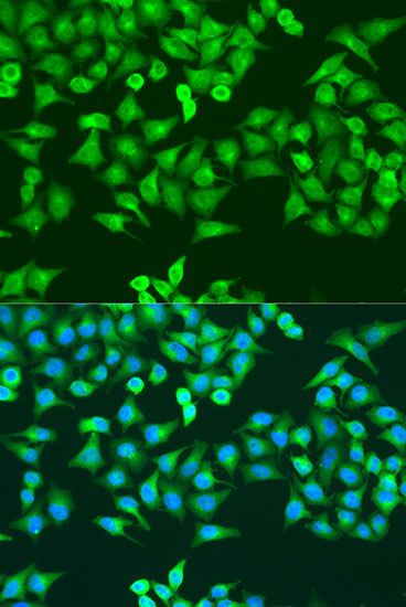 Immunofluorescence - RRM1 Polyclonal Antibody (144-602928)