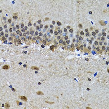Immunohistochemistry - SPIN1 antibody (144-05853)