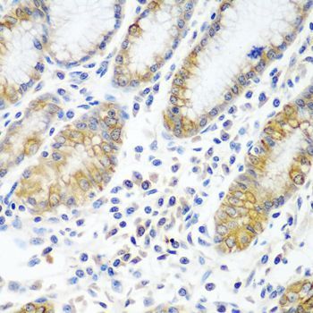 Immunohistochemistry - ATAD3A antibody (144-08230)
