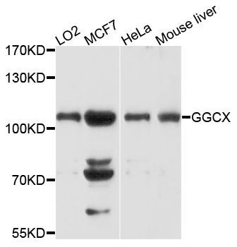 Western blot - GGCX antibody (144-01806)