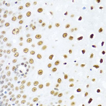 Immunohistochemistry - SSB Polyclonal Antibody (144-00630)