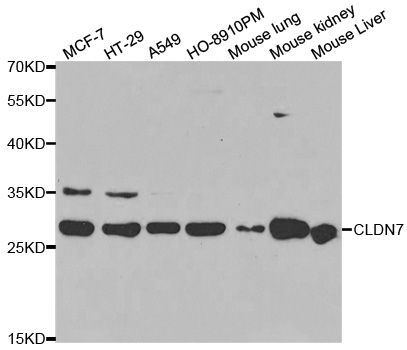 Western blot - CLDN7 Polyclonal Antibody (144-02035)