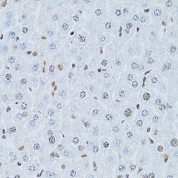 Immunohistochemistry - HNF4A Antibody (144-02085)
