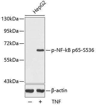 Western blot