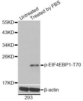 Western blot - Phospho-EIF4EBP1-T70 pAb (144-61487)