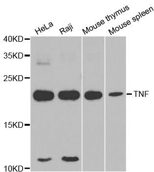Western blot - TNF-? Polyclonal Antibody (144-011534)