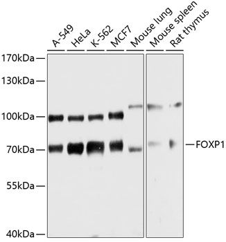 Western blot