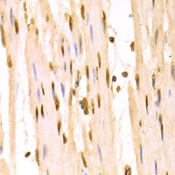 Immunohistochemistry - SFN Polyclonal Antibody (144-01026)