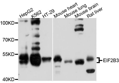 Western blot - EIF2B3 Polyclonal Antibody (144-010262)