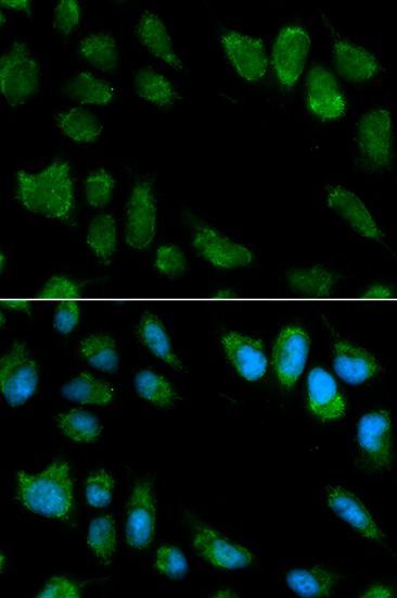Immunofluorescence - IL1RN antibody (144-02088)
