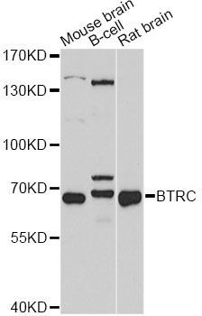 Western blot - BTRC Polyclonal Antibody (144-01656)