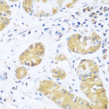 Immunohistochemistry - UCHL3 antibody (144-08156)