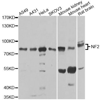 Western blot - [KO Validated] NF2 Polyclonal Antibody (144-60029)