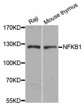 Western blot - [KO Validated] NFKB1 Polyclonal Antibody (144-06667)