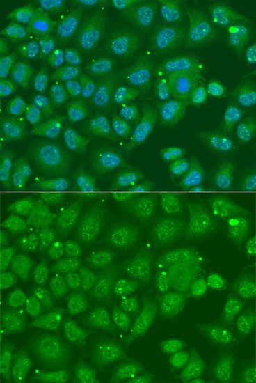 Immunofluorescence - ANXA8L2 antibody (144-07641)