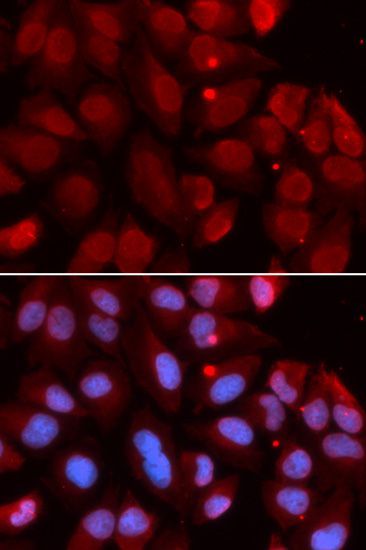 Immunofluorescence - RAG2 Polyclonal Antibody (144-05626)