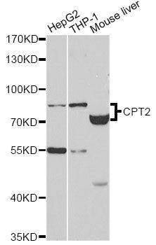 Western blot - CPT2 antibody (144-02876)