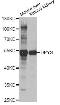 Western blot - DPYS antibody (144-06368)