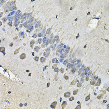 Immunohistochemistry - MYH1 Antibody (144-06935)
