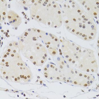 Immunohistochemistry - HNRNPA1 Polyclonal Antibody (144-07491)