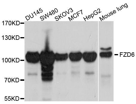 Western blot - FZD6 Polyclonal Antibody (144-600563)