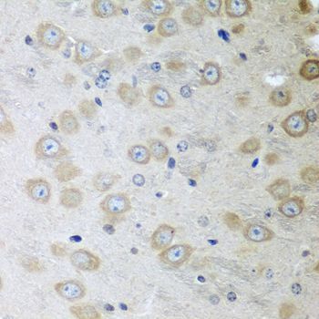 Immunohistochemistry - ATAD3A antibody (144-08230)