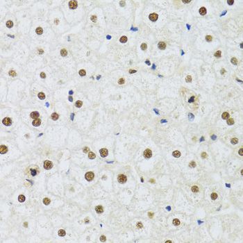 Immunohistochemistry - DDB1 Polyclonal Antibody (144-02896)