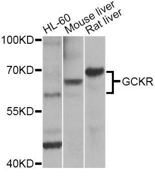 Western blot - GCKR Antibody (144-05678)