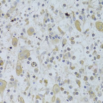 Immunohistochemistry - MAP2K5 Polyclonal Antibody (144-06953)