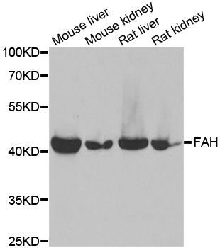 Western blot - FAH antibody (144-60359)