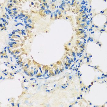 Immunohistochemistry - ABCF2 antibody (144-04365)
