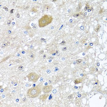 Immunohistochemistry - CST1 antibody (144-06570)