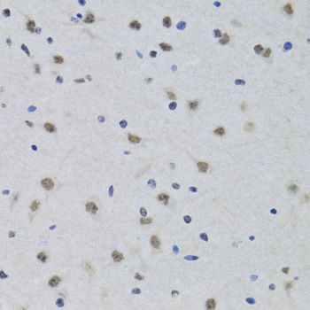 Immunohistochemistry - PRPF19 antibody (144-06706)