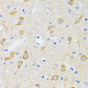 Immunohistochemistry - HSPH1 antibody (144-06622)