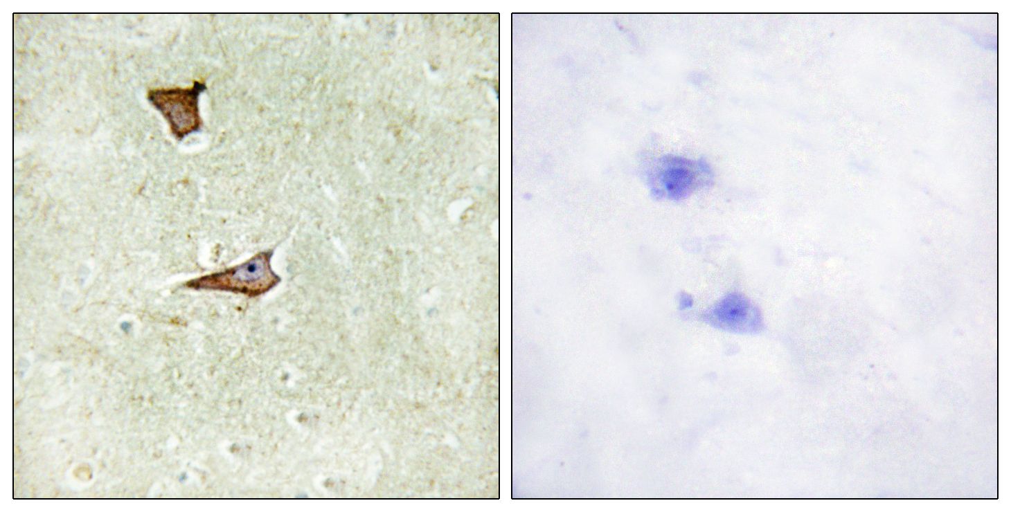 IHC