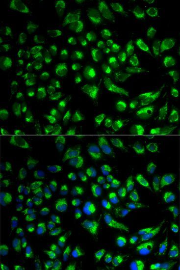 Immunofluorescence - SPAM1 antibody (144-02120)