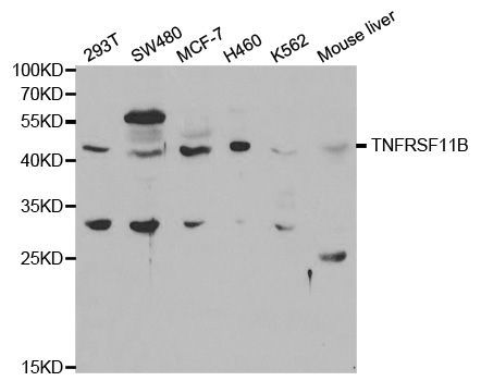 Western blot - TNFRSF11B Polyclonal Antibody (144-02100)