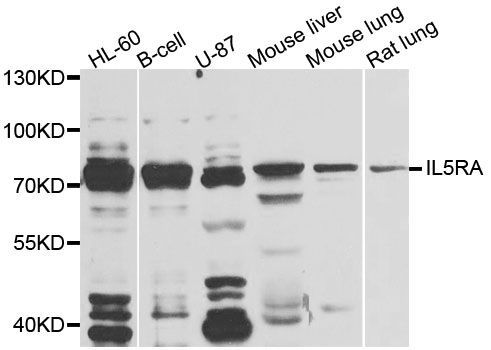 Western blot - IL5RA antibody (144-08552)