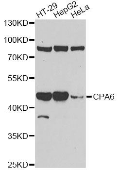 Western blot - CPA6 antibody (144-60428)
