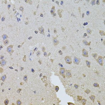 Immunohistochemistry - ITGB8 antibody (144-08433)