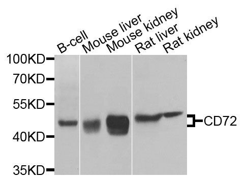 Western blot - CD72 antibody (144-09930)