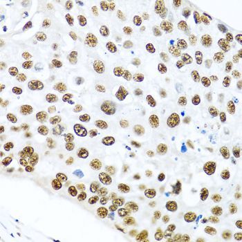 Immunohistochemistry - METTL3 Polyclonal Antibody (144-08370)
