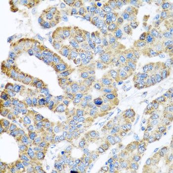Immunohistochemistry - ATPIF1 Polyclonal Antibody (144-05099)