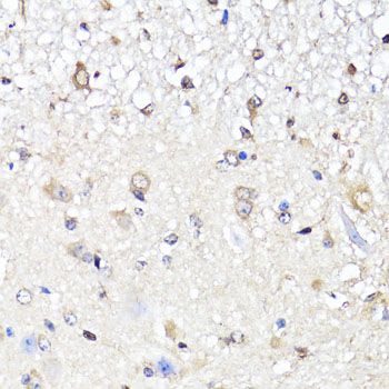 Immunohistochemistry - [KO Validated] YAP1 Polyclonal Antibody (144-01002)