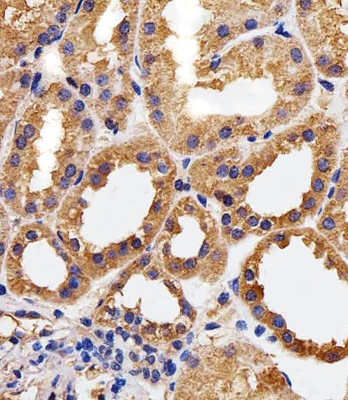 IHC-P